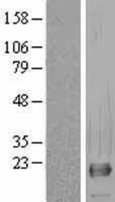 Western Blot: RNF11 Overexpression Lysate (Adult Normal) [NBL1-15408] Left-Empty vector transfected control cell lysate (HEK293 cell lysate); Right -Over-expression Lysate for RNF11.