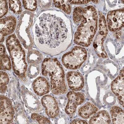 Immunohistochemistry-Paraffin: RNF111 Antibody [NBP1-94139] - Staining of human kidney shows strong cytoplasmic positivity in cells in tubules.