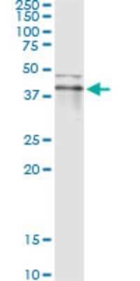 Immunoprecipitation: RNF113B Antibody (2B11) [H00140432-M02] - Analysis of RNF113B transfected lysate using anti-RNF113B monoclonal antibody and Protein A Magnetic Bead, and immunoblotted with RNF113B MaxPab rabbit polyclonal antibody.