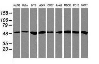 Western Blot: RNF113B Antibody (7A1) [NBP2-01644] Analysis of extracts (35ug) from 9 different cell lines by using anti-RNF113B monoclonal antibody.