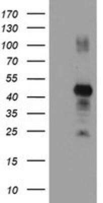 Western Blot: RNF113B Antibody (OTI7A1) - Azide and BSA Free [NBP2-73921] - HEK293T cells were transfected with the pCMV6-ENTRY control (Left lane) or pCMV6-ENTRY RNF113B (Right lane) cDNA for 48 hrs and lysed. Equivalent amounts of cell lysates (5 ug per lane) were separated by SDS-PAGE and immunoblotted with anti-RNF113B.