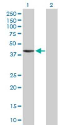 Western Blot: RNF113B Antibody [H00140432-D01P] - Analysis of RNF113B expression in transfected 293T cell line by RNF113B polyclonal antibody.Lane 1: RNF113B transfected lysate(36.30 KDa).Lane 2: Non-transfected lysate.