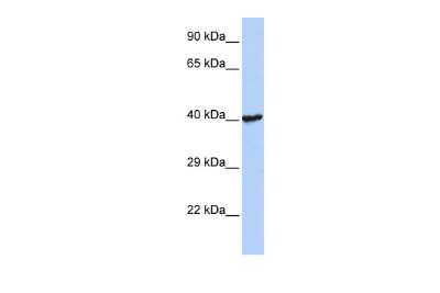 Western Blot: RNF113B Antibody [NBP3-10347] - Western blot analysis using NBP3-10347 on Human Jurkat as a positive control. Antibody Titration: 0.2-1 ug/ml