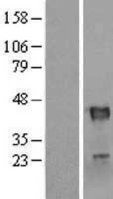 Western Blot: RNF113B Overexpression Lysate (Adult Normal) [NBL1-15412] Left-Empty vector transfected control cell lysate (HEK293 cell lysate); Right -Over-expression Lysate for RNF113B.