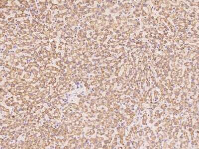 Immunohistochemistry-Paraffin: RNF114 Antibody [NBP2-97786] - Staining of human RNF114 in human liver with rabbit polyclonal antibody at 1:100 dilution.