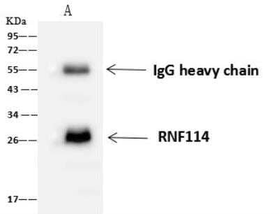 Immunoprecipitation: RNF114 Antibody [NBP2-97786] - Lane A:0.5 mg 293T Whole Cell Lysate4 uL anti-RNF114 rabbit polyclonal antibody and 60 ug of Immunomagnetic beads Protein A/G.Primary antibody:Anti-RNF114 rabbit polyclonal antibody,at 1:100 dilution Secondary antibody:Goat Anti-Rabbit IgG (H+L)/HRP at 1/10000 dilutionDeveloped using the ECL technique.Performed under reducing conditions.Predicted band size: 26 kDaObserved band size :26 kDa