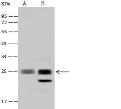 Western Blot: RNF114 Antibody [NBP2-97786] - Lane A: HepG2 Whole Cell LysateLane B: 293T Whole Cell LysateLysates/proteins at 30 ug per lane.SecondaryGoat Anti-Rabbit IgG (H+L)/HRP at 1/10000 dilution.Developed using the ECL technique.Performed under reducing conditions.Predicted band size:26 kDaObserved band size:26 kDa
