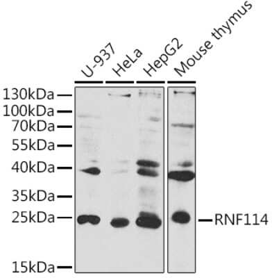 Western Blot: RNF114 Antibody [NBP3-15333] - Western blot analysis of extracts of various cell lines, using RNF114 antibody (NBP3-15333) at 1:1000 dilution. Secondary antibody: HRP Goat Anti-Rabbit IgG (H+L) at 1:10000 dilution. Lysates/proteins: 25ug per lane. Blocking buffer: 3% nonfat dry milk in TBST. Detection: ECL Basic Kit. Exposure time: 10s.