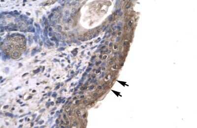 Immunohistochemistry: RNF12 Antibody [NBP3-10928] - Immunohistochemical analysis of human spermatophore.