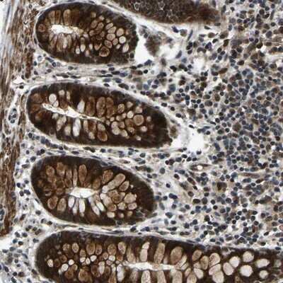 Immunohistochemistry-Paraffin: RNF12 Antibody [NBP1-89571] - Staining of human colon shows cytoplasmic and nuclear positivity in glandular cells.