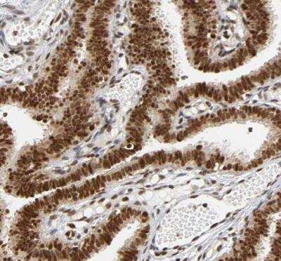 Immunohistochemistry-Paraffin RNF122 Antibody - BSA Free