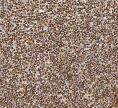 Immunohistochemistry-Paraffin RNF122 Antibody - BSA Free