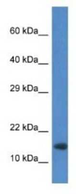 Western Blot: RNF122 Antibody [NBP1-74191] - Mouse Heart lysate, concentration 1 ug/ml.