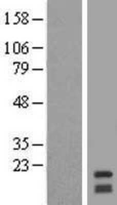 Western Blot: RNF122 Overexpression Lysate (Adult Normal) [NBL1-15416] Left-Empty vector transfected control cell lysate (HEK293 cell lysate); Right -Over-expression Lysate for RNF122.