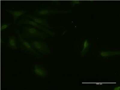 Immunocytochemistry/Immunofluorescence: RNF125 Antibody (1D3) [H00054941-M03] - Analysis of monoclonal antibody to RNF125 on HeLa cell. Antibody concentration 10 ug/ml