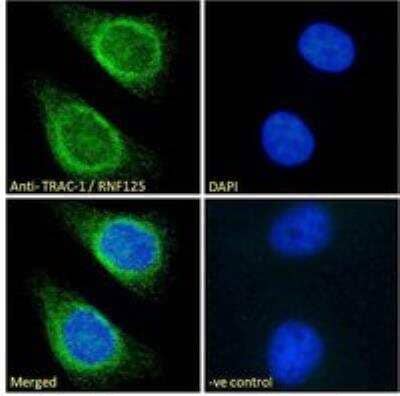 Immunocytochemistry/ Immunofluorescence RNF125 Antibody