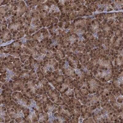 Immunohistochemistry-Paraffin: RNF125 Antibody [NBP1-83653] - Staining of human pancreas shows moderate cytoplasmic and nuclear positivity in exocrine pancreas.