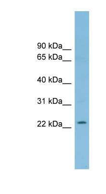 Western Blot: RNF125 Antibody [NBP1-55373] - THP-1 cell lysate, concentration 0.2-1 ug/ml.