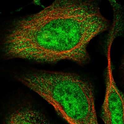 Immunocytochemistry/Immunofluorescence: RNF126 Antibody [NBP1-83645] - Staining of human cell line U-2 OS shows localization to nucleoplasm & cytosol. Antibody staining is shown in green.