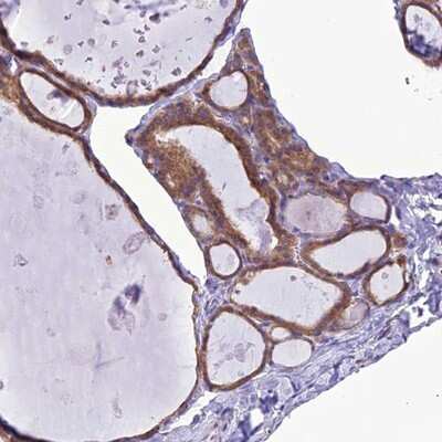 Immunohistochemistry-Paraffin: RNF126 Antibody [NBP1-83645] - Staining of human thyroid gland shows moderate cytoplasmic positivity in glandular cells.