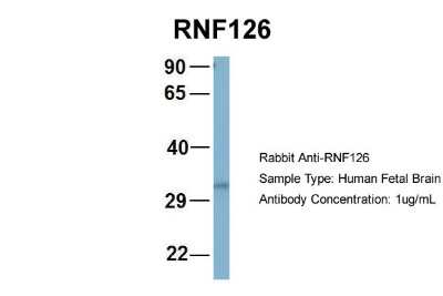 Western Blot: RNF126 Antibody [NBP1-55058] - Sample Type: Human Fetal Brain Antibody Dilution: 1.0 ug/ml