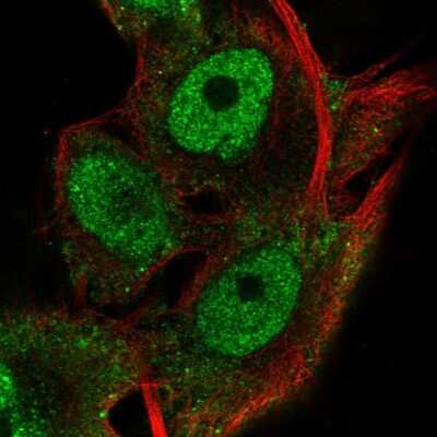 Immunocytochemistry/ Immunofluorescence RNF13 Antibody