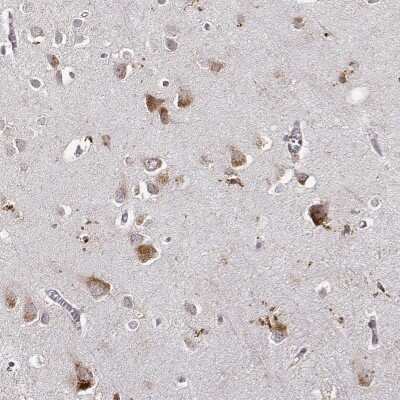 Immunohistochemistry-Paraffin RNF13 Antibody