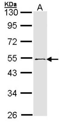Western Blot: RNF13 Antibody [NBP1-31251] - Sample (30 ug of whole cell lysate) A: 293T 10% SDS PAGE; antibody diluted at 1:1000.