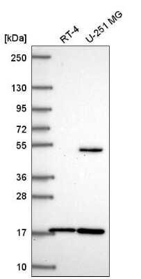 Western Blot RNF13 Antibody