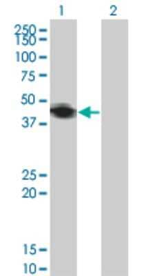 Western Blot: RNF133 Antibody (3D6) [H00168433-M01] - Analysis of RNF133 expression in transfected 293T cell line by RNF133 monoclonal antibody (M01), clone 3D6.Lane 1: RNF133 transfected lysate(42.3 KDa).Lane 2: Non-transfected lysate.