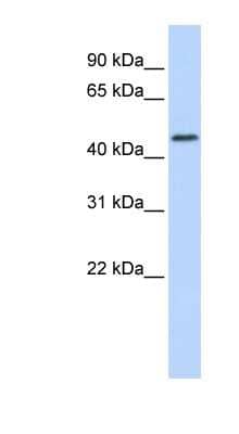 Western Blot: RNF133 Antibody [NBP1-62487] - Human Brain lysate, concentration 0.2-1 ug/ml.
