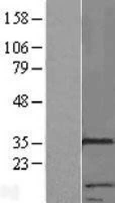Western Blot: RNF133 Overexpression Lysate (Adult Normal) [NBP2-05594] Left-Empty vector transfected control cell lysate (HEK293 cell lysate); Right -Over-expression Lysate for RNF133.