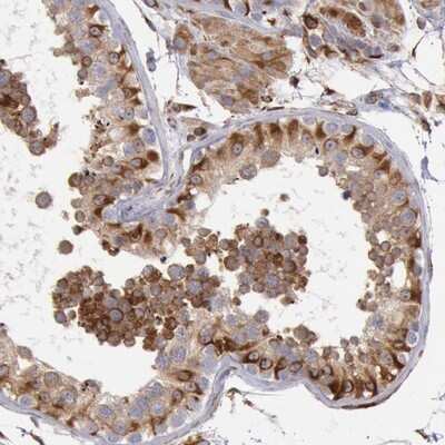 Immunohistochemistry-Paraffin: RNF139 Antibody [NBP1-83212] - Staining of human testis shows strong cytoplasmic positivity in cells in seminiferus ducts.