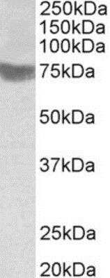 Western Blot: RNF139 Antibody [NBP1-23027] - (1ug/ml) staining of Human Skeletal Muscle lysate (35ug protein in RIPA buffer). Primary incubation was 1 hour. Detected by chemiluminescence.