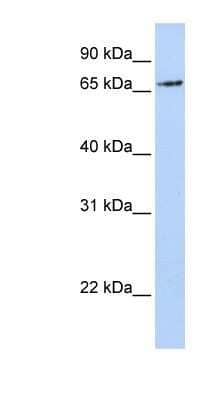 Western Blot: RNF139 Antibody [NBP1-59756] - Titration: 0.2-1 ug/ml, Positive Control: MCF7 cell lysate.