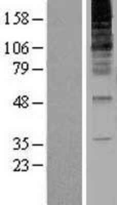 Western Blot: RNF139 Overexpression Lysate (Adult Normal) [NBL1-15424] Left-Empty vector transfected control cell lysate (HEK293 cell lysate); Right -Over-expression Lysate for RNF139.