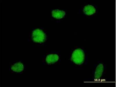 Immunocytochemistry/ Immunofluorescence RNF144A Antibody - Azide and BSA Free