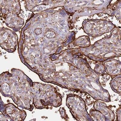Immunohistochemistry-Paraffin: RNF144A Antibody [NBP2-13238] - Staining of human placenta shows strong membranous positivity in trophoblastic cells.