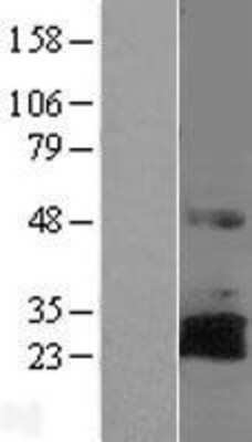 Western Blot RNF144A Overexpression Lysate