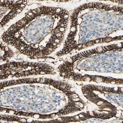 Immunohistochemistry-Paraffin: RNF149 Antibody [NBP1-83440] - Staining of human small intestine shows distinct membranous positivity in glandular cells.
