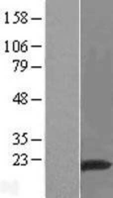 Western Blot: RNF149 Overexpression Lysate (Adult Normal) [NBP2-05126] Left-Empty vector transfected control cell lysate (HEK293 cell lysate); Right -Over-expression Lysate for RNF149.