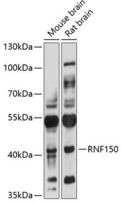 Western Blot: RNF150 Antibody [NBP2-94857] - Analysis of extracts of various cell lines, using RNF150 at 1:3000 dilution. Secondary antibody: HRP Goat Anti-Rabbit IgG (H+L) at 1:10000 dilution. Lysates/proteins: 25ug per lane. Blocking buffer: 3% nonfat dry milk in TBST. Detection: ECL Basic Kit . Exposure time: 10s.