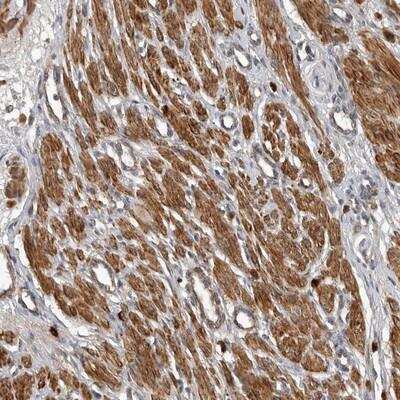 Immunohistochemistry-Paraffin: RNF157 Antibody [NBP1-81359] - Staining of human smooth muscle shows strong cytoplasmic positivity in smooth muscle cells.