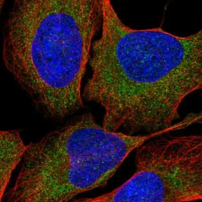 Immunocytochemistry/ Immunofluorescence RNF160 Antibody