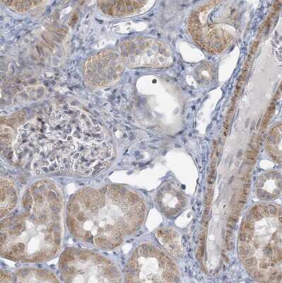 Immunohistochemistry-Paraffin: RNF160 Antibody [NBP1-89879] - Staining of human kidney shows weak cytoplasmic positivity in cells in tubules.