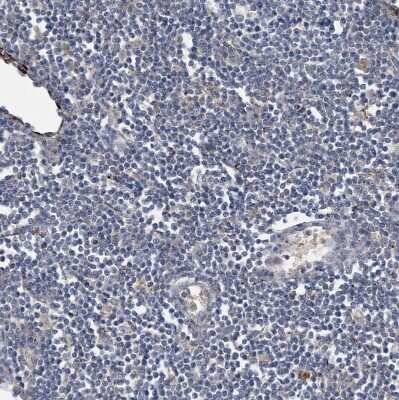 Immunohistochemistry-Paraffin: RNF160 Antibody [NBP1-89879] - Staining of human lymph node shows no cytoplasmic positivity in non-germinal center cells as expected.