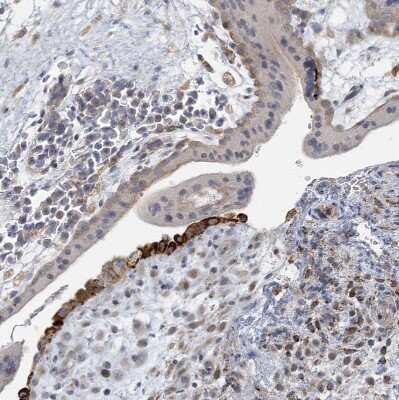 Immunohistochemistry-Paraffin: RNF160 Antibody [NBP1-89879] - Staining of human placenta shows moderate cytoplasmic positivity in trophoblastic cells.