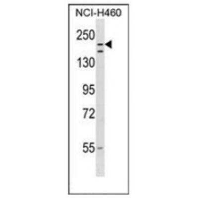 Western Blot: RNF160 Antibody [NBP2-33341] - Analysis of  in NCIH460 cell line lysates (35ug/lane).This demonstrates the RNF160 antibody detected the RNF160 protein (arrow).