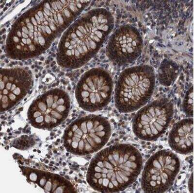 Immunohistochemistry: RNF165 Antibody [NBP2-30675] - Staining of human colon shows strong cytoplasmic and nuclear positivity in glandular cells.