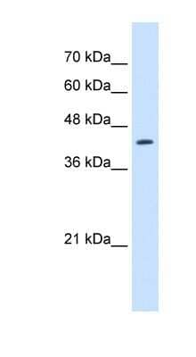 Western Blot: RNF165 Antibody [NBP1-70695] - Jurkat cell lysate, concentration 2.5 ug/ml.